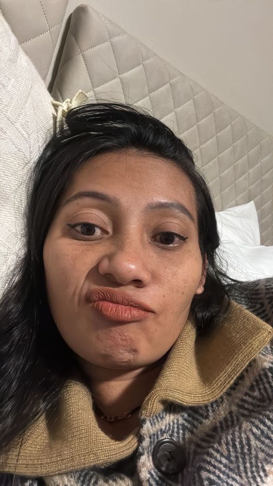 NF