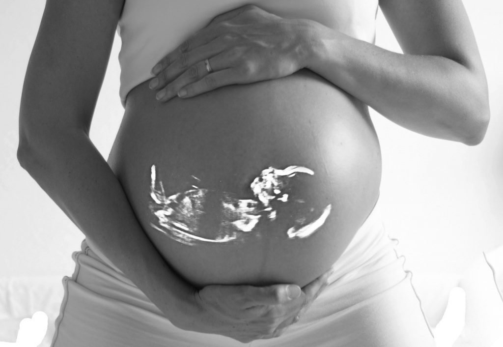 janin dalam perut ibu dapat dilihat melalui USG